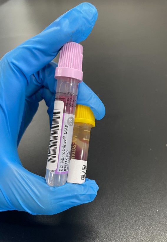 The Science Behind Minimal-Volume Blood Testing: How HealthieOne Analyzes 200+ Markers from Less Than 1mL