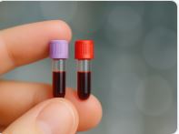 The Science Behind Minimal-Volume Blood Testing: How HealthieOne Analyzes 200+ Markers from Less Than 1mL