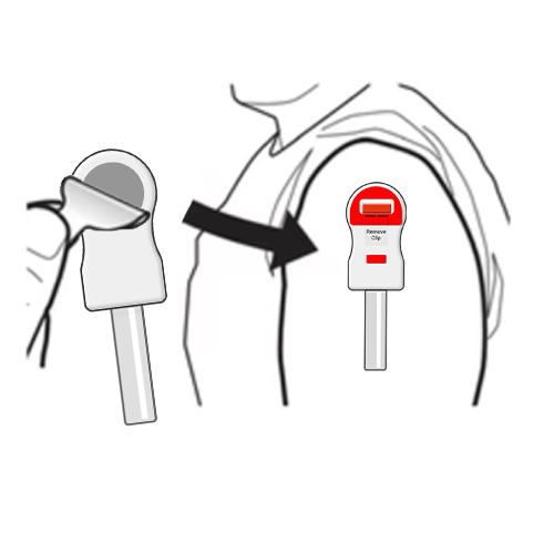 Apply blood collection device