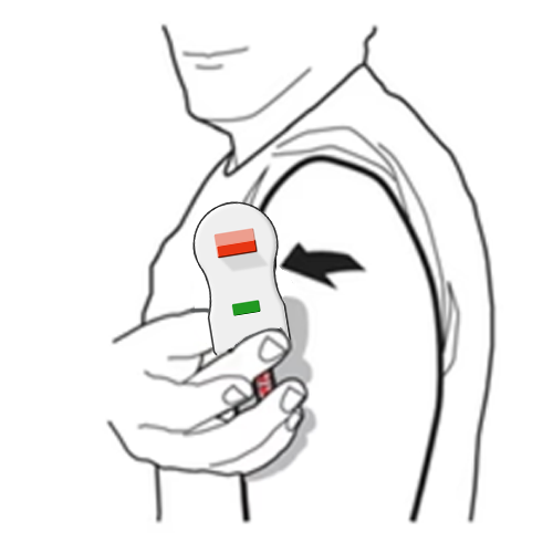 Remove device